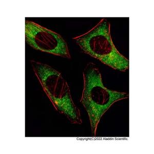 AMPK alpha 2 Mouse mAb,AMPK alpha 2 Mouse mAb