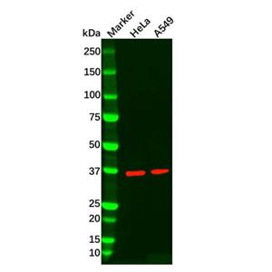 aladdin 阿拉丁 Ab088680 Recombinant AMPK gamma 1 Antibody Recombinant (R05-2F6); Rabbit anti Human AMPK gamma 1 Antibody; WB, ICC, IF; Unconjugated