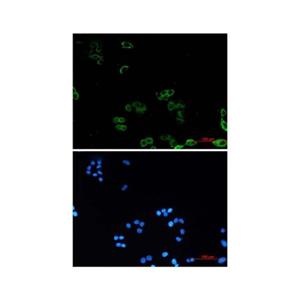 Recombinant AMPK gamma 1 Antibody,Recombinant AMPK gamma 1 Antibody