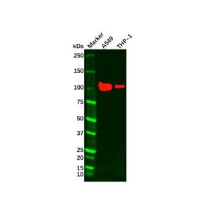 aladdin 阿拉丁 Ab088758 Recombinant Androgen Receptor Antibody Recombinant (RR632); Rabbit anti Human Androgen Receptor Antibody; WB, IHC; Unconjugated