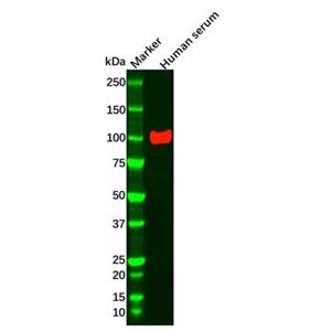 Angiostatin Mouse mAb,Angiostatin Mouse mAb