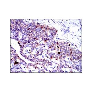 Annexin A1/ANXA1 Mouse mAb,Annexin A1/ANXA1 Mouse mAb