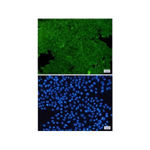 Recombinant ANXA2 Antibody,Recombinant ANXA2 Antibody