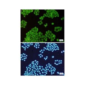 Recombinant Annexin-6/ANXA6 Antibody,Recombinant Annexin-6/ANXA6 Antibody