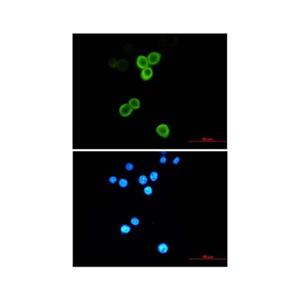 Recombinant Anterior Gradient 2 Antibody,Recombinant Anterior Gradient 2 Antibody