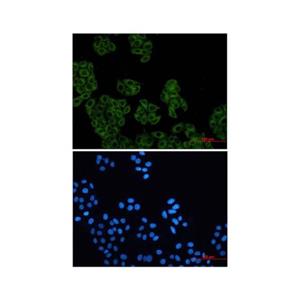 Recombinant Arp2 Antibody,Recombinant Arp2 Antibody