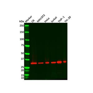 aladdin 阿拉丁 Ab089679 Recombinant ARPC2 Antibody Recombinant (R04-1B6); Rabbit anti Human ARPC2 Antibody; WB, IHC, ICC, IF; Unconjugated