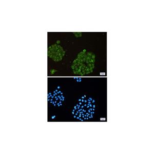 Recombinant ARPC2 Antibody,Recombinant ARPC2 Antibody