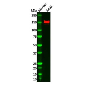 ASK1 Antibody,ASK1 Antibody