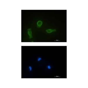 Recombinant Bcl-XL Antibody,Recombinant Bcl-XL Antibody