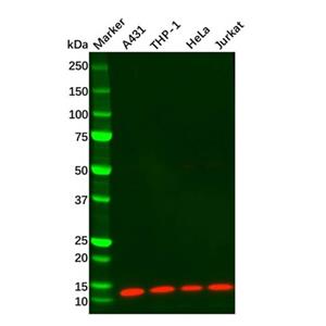 aladdin 阿拉丁 Ab090968 Beta 2 Microglobulin Mouse mAb mAb (C1); Mouse anti Human Beta 2 Microglobulin Antibody; WB, IHC; Unconjugated