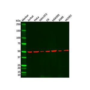 aladdin 阿拉丁 Ab091154 Recombinant beta III Tubulin Antibody Recombinant (RR607); Rabbit anti Human Beta III Tubulin Antibody; WB, Flow; Unconjugated