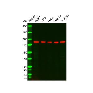 aladdin 阿拉丁 Ab091608 BRAF Mouse mAb mAb (125CT13.3.5); Mouse anti Human BRAF Antibody; WB, ICC, IF; Unconjugated