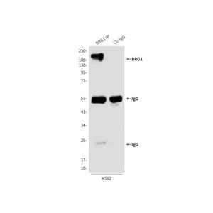 BRG1 Mouse mAb,BRG1 Mouse mAb