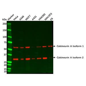 aladdin 阿拉丁 Ab092408 Recombinant Calcineurin A Antibody Recombinant (R01-6F5); Rabbit anti Human Calcineurin A Antibody; WB; Unconjugated