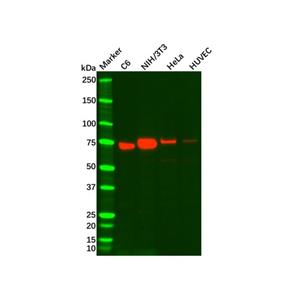 aladdin 阿拉丁 Ab092465 Recombinant Caldesmon/CDM Antibody Recombinant (R05-3D2); Rabbit anti Human Caldesmon/CDM Antibody; WB, IHC; Unconjugated
