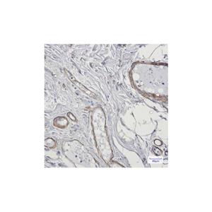 Recombinant Caldesmon/CDM Antibody,Recombinant Caldesmon/CDM Antibody