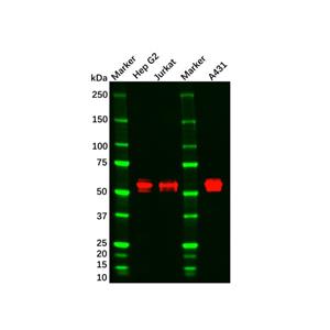 aladdin 阿拉丁 Ab092652 CaMKII Mouse mAb mAb (8G10C1); Mouse anti Human/Rat CaMKII Antibody; WB, IHC, Flow, ELISA; Unconjugated