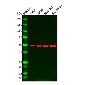 Recombinant CaMKII delta Antibody,Recombinant CaMKII delta Antibody