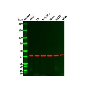 aladdin 阿拉丁 Ab092682 Recombinant PRKACA Antibody Recombinant (R07-8H3); Rabbit anti Human cAMP Protein Kinase Catalytic subunit Antibody; WB, IHC, ICC, IF; Unconjugated