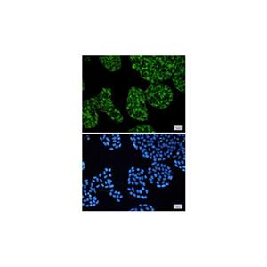 Recombinant PRKACA Antibody,Recombinant PRKACA Antibody