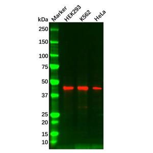 aladdin 阿拉丁 Ab092954 Casein Kinase 1 delta/CSNK1D Mouse mAb mAb(C3); Mouse anti Human Casein Kinase 1 delta/CSNK1D Antibody; WB, IHC; Unconjugated