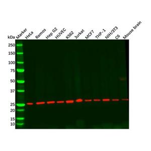 aladdin 阿拉丁 Ab092961 Recombinant Casein Kinase 2 beta Antibody Recombinant (R01-5D5); Rabbit anti Human Casein Kinase 2 beta Antibody; WB, IHC, IF, ICC; Unconjugated