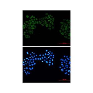 Recombinant Casein Kinase 2 beta Antibody,Recombinant Casein Kinase 2 beta Antibody