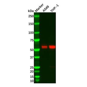 aladdin 阿拉丁 Ab093061 Recombinant Caspase-8 Antibody Recombinant (R06-3K2); Rabbit anti Human Caspase-8 Antibody; WB, IHC, ICC, IF; Unconjugated
