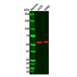 Recombinant Caspase-8 Antibody,Recombinant Caspase-8 Antibody