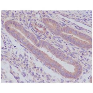 Recombinant Caspase-8 Antibody,Recombinant Caspase-8 Antibody