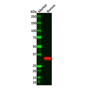 Recombinant CD20 Antibody,Recombinant CD20 Antibody