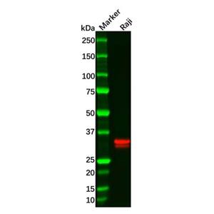 Recombinant CD20 Antibody,Recombinant CD20 Antibody