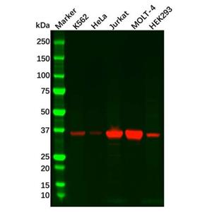 Recombinant Cdk6 Antibody,Recombinant Cdk6 Antibody