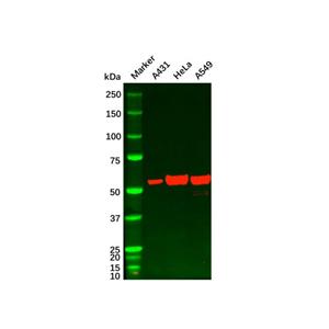 aladdin 阿拉丁 Ab096310 Chk1 Mouse mAb mAb(2G1D5); Mouse anti Human Chk1 Antibody; WB, ELISA; Unconjugated