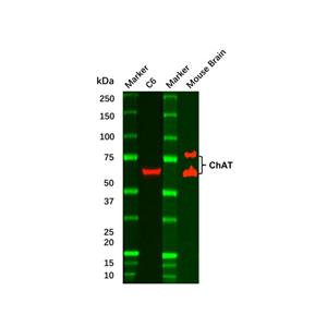aladdin 阿拉丁 Ab096389 Recombinant Choline Acetyltransferase Antibody Recombinant(R07-1G8); Rabbit anti Human Choline Acetyltransferase  Antibody; WB, ICC, IF; Unconjugated
