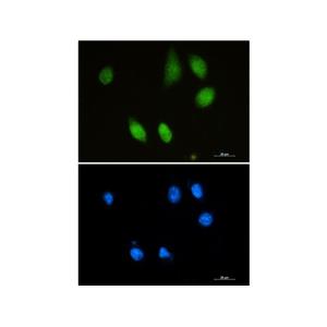 Recombinant Choline Acetyltransferase Antibody,Recombinant Choline Acetyltransferase Antibody