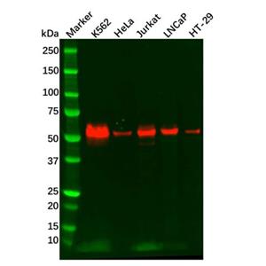aladdin 阿拉丁 Ab097003 Recombinant c-Myc Antibody Recombinant (R05-5E2); Rabbit anti Human c-Myc Antibody; WB, IF, ICC; Unconjugated
