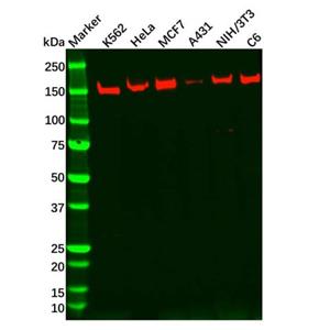 aladdin 阿拉丁 Ab097188 Recombinant Collagen III Antibody Recombinant (R06-4E1); Rabbit anti Human Collagen III Antibody; WB, ICC, IF; Unconjugated