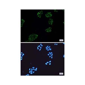 Recombinant Collagen III Antibody,Recombinant Collagen III Antibody