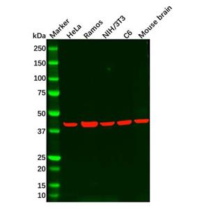 aladdin 阿拉丁 Ab097971 Recombinant CSNK2A1 Antibody Recombinant (R05-7F8); Rabbit anti Human CSNK2A1 Antibody; WB; Unconjugated