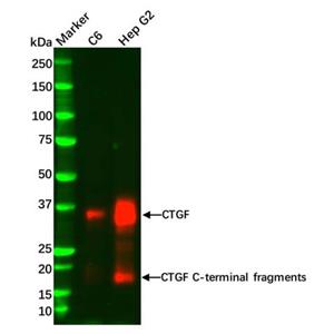 aladdin 阿拉丁 Ab098051 Recombinant CTGF Antibody Recombinant (R08-8C2); Rabbit anti Human CTGF Antibody; WB; Unconjugated