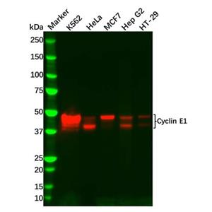 aladdin 阿拉丁 Ab098463 Recombinant Cyclin E1 Antibody Recombinant (R08-2A1); Rabbit anti Human Cyclin E1 Antibody; WB; Unconjugated