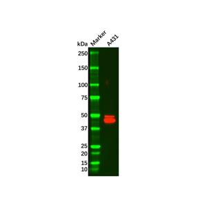 aladdin 阿拉丁 Ab098806 Recombinant Cytokeratin 14 Antibody Recombinant (R02-7I6); Rabbit anti Human Cytokeratin 14 Antibody; WB, IHC; Unconjugated