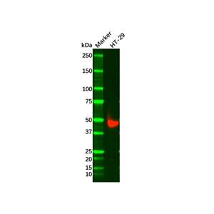 aladdin 阿拉丁 Ab098925 Recombinant Cytokeratin 20 Antibody Recombinant (RR648); Rabbit anti Human Cytokeratin 20 Antibody; WB, IHC, ICC, IF, Flow, IP; Unconjugated