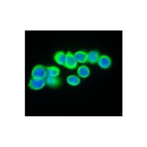 Recombinant Cytokeratin 20 Antibody,Recombinant Cytokeratin 20 Antibody