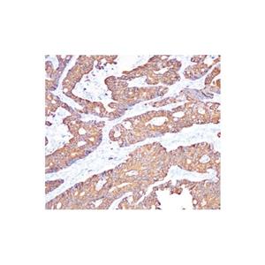 Recombinant Cytokeratin 20 Antibody,Recombinant Cytokeratin 20 Antibody