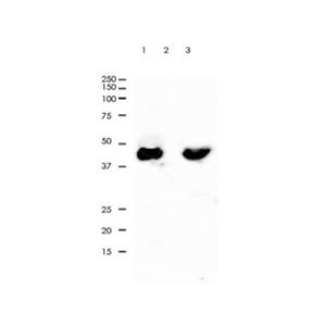 Recombinant Cytokeratin 20 Antibody,Recombinant Cytokeratin 20 Antibody