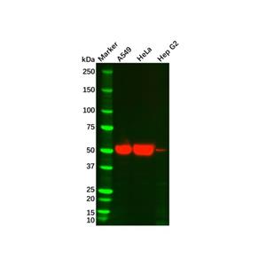 aladdin 阿拉丁 Ab099003 Cytokeratin 7 Mouse mAb mAb (C2); Mouse anti Human Cytokeratin 7 Antibody; WB; Unconjugated