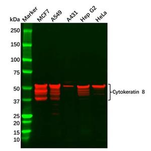 Cytokeratin 8 Antibody,Cytokeratin 8 Antibody